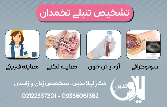 تشخیص تنبلی تخمدان