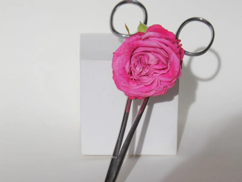 عوارض لابیاپلاستی