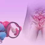 کیست های تخمدان