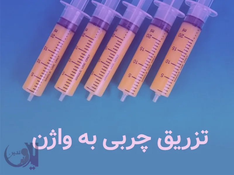 همه چیز در مورد تزریق چربی به واژن