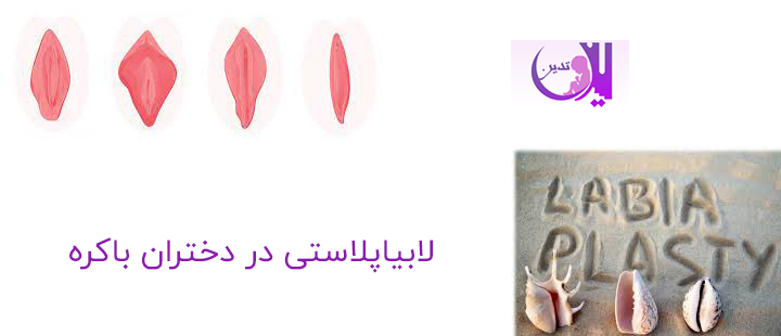 لابیاپلاستی در دختران باکره