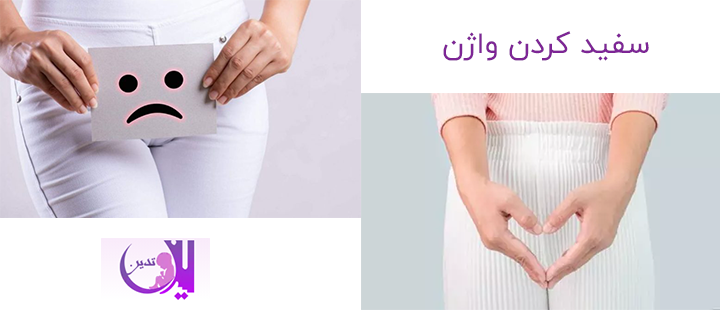 سفید کردن واژن