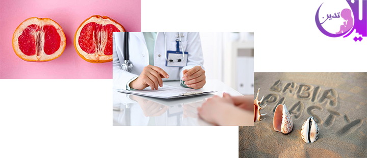 لابیاپلاستی با لیزر مونالیزا چیست؟