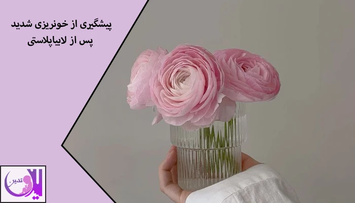 پیشگیری از خونریزی شدید پس از لابیاپلاستی